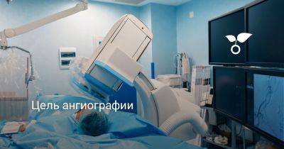 Цель ангиографии - botanichka.ru - Москва
